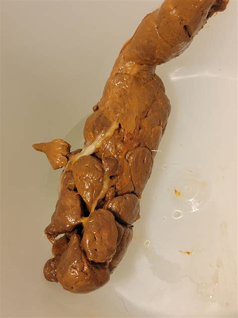 White Fluffy Mucus In Stool