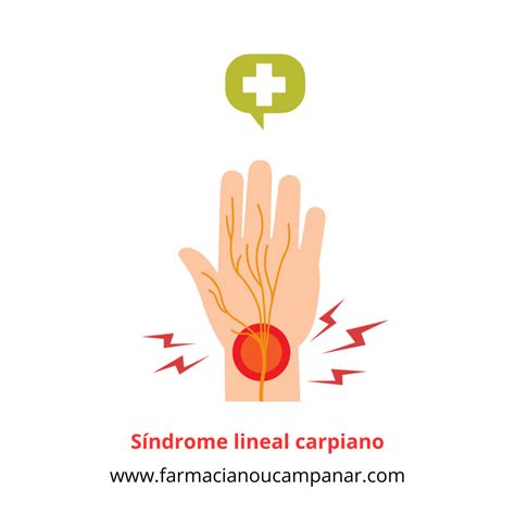 El síndrome del túnel carpiano en el embarazo - Farma fertilidad