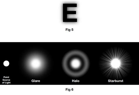 Presbyopia IOL 的图像结果