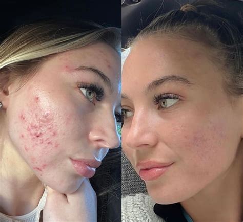 Image result for Ruci Quick Set