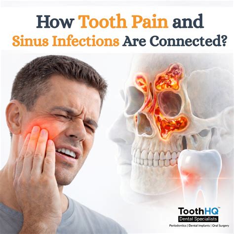 How Tooth Pain and Sinus Infections Are Connected—And Why It Matters More Than You Think ...