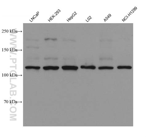 FGFR3 antibody (66954-1-Ig) | Proteintech