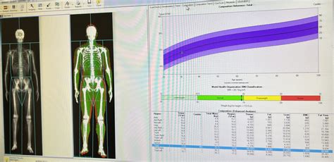 Dexa Scan Cost