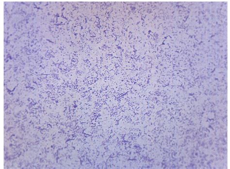 Image result for Bacteria Microscope Slides