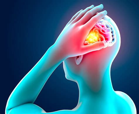 ¿Qué es un aneurisma cerebral? - BrandStudio - Primera Hora