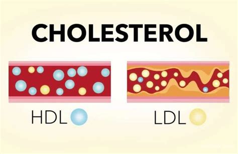 Image result for HDL Components Code