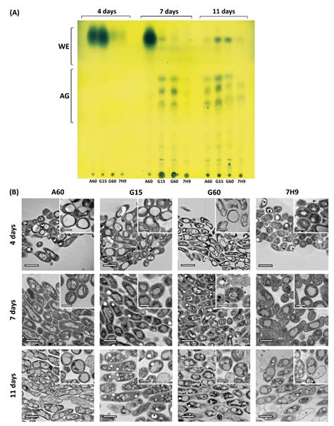 The High Plasticity of Nonpathogenic Mycobacterium brumae Induces Rapid ...