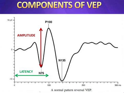Visual evoked potential and evoked potential test