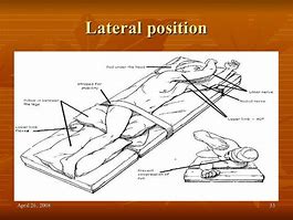 Image result for Lateral Patient Position