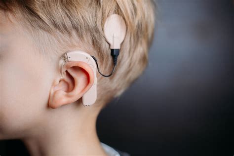 Cochlear Implant in Deaf Children with Autism Can Improve Language ...
