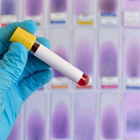 WHO untersucht Zusammenhang zwischen Covid und Hepatitis-Fällen bei Ki ...