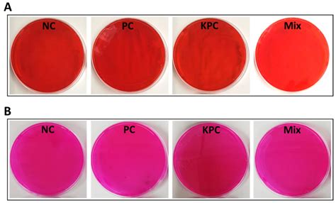 Sustainable Cosmetics: Valorisation of Kiwi (Actinidia deliciosa) By ...