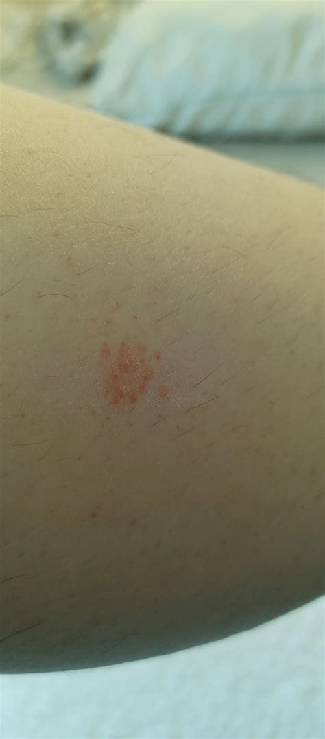 HELP idk why but this red dot wont disappear? : r/SkincareAddicts