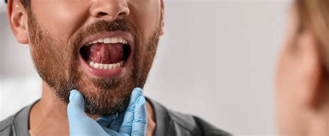 Mucositis: causes and treatment | CURAPROX