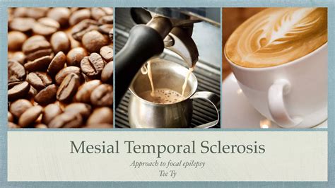 Mesial temporal sclerosis cme | PDF