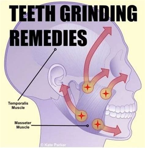 How to Stop Grinding Your Teeth | HealthProAdvice