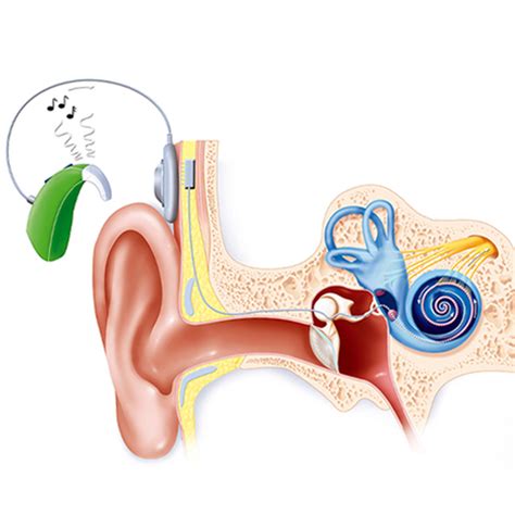 How do we screen hearing in patients presenting with ear problems? | Dr ...