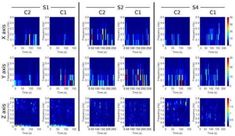 Analysis of the Motion Sickness and the Lack of Comfort in Car Passengers