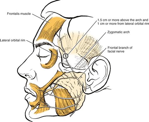 The Aesthetic Brow and Forehead - Clinical Tree