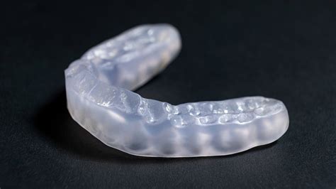 What is an Occlusal Mouth Guard for Grinding Teeth – Diamond Braces