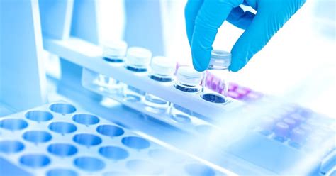Research On Molecular Biology Kits And Reagents Market Report 2018 to ...