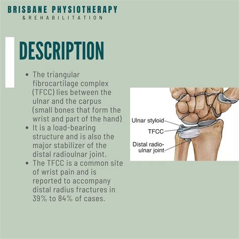 What is a TFCC tear? - Brisbane Physiotherapy