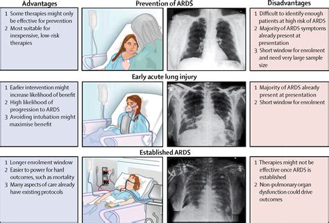 Clinical trials in acute respiratory distress syndrome: challenges and opportunities - The ...