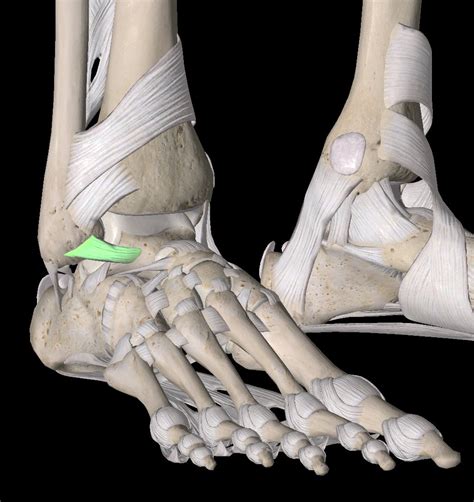 Physical Therapy for Ankle Sprains | Brooklyn, NYC - The Game Plan ...