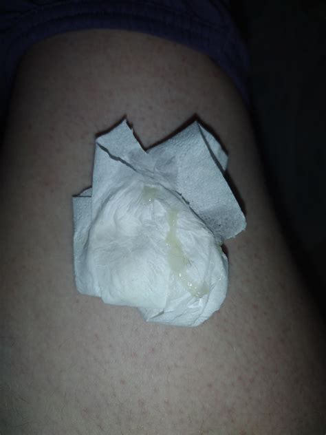 Mucus Plug Discharge Mucus Plug After Sweep?? (tmi!!! Warning)