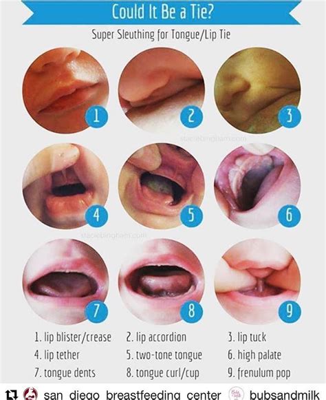 Breastfeeding Newborn Lips at Dorla Walker blog