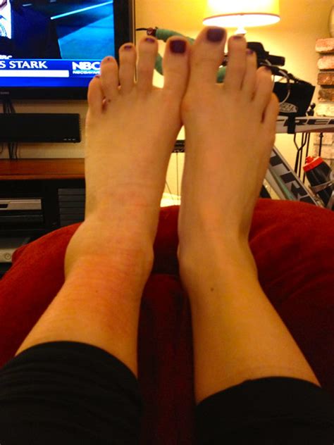 Injured, Sick & How To Treat A Sprained Ankle – Twenty-Six & Then Some