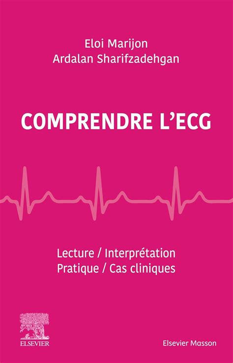 Buy Comprendre l'ECG: Lecture - Interprétation - Pratique - Cas ...