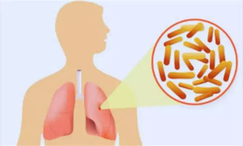 Urine bicarbonate test offers new, safe quantification of CFTR function ...