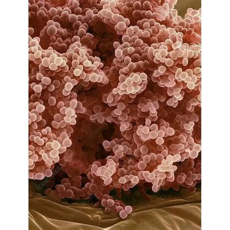 Lactococcus Species in Milk Kefir Grains: Beneficial