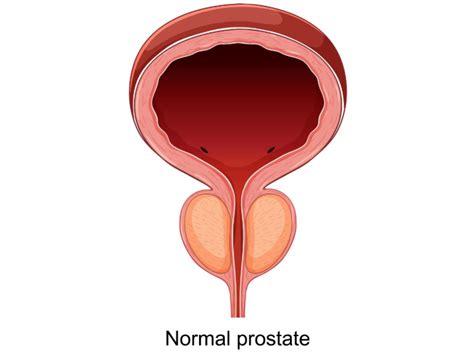 Image result for Normal Prostate Levels