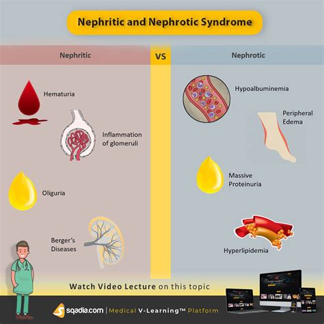 Nephritic and nephrotic syndrome – Artofit