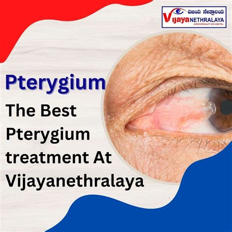 Pterygium Eye Treatment: Understanding Causes Symptoms
