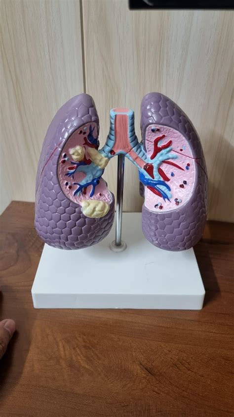 GD ANATOMICALS® "Lung Model - Educational Tool for Medical Study ...