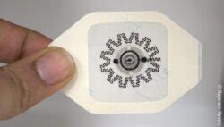 Electric bandage promotes faster healing of chronic wounds