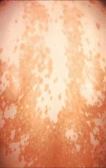 Videos | Skin | Dr. Dixit Cosmetic Dermatology | Page 1