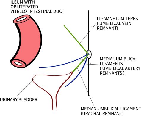 Median Umbilical Ligament