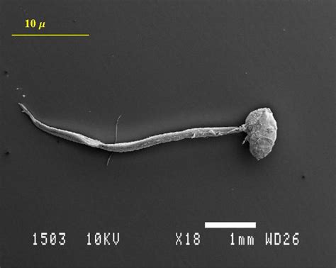 Image result for How to Add Scale Bar On Micrograph