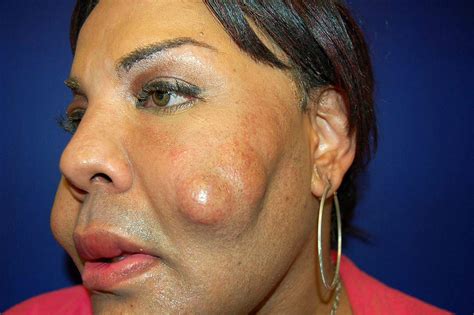 Plastic Surgery Disasters 的图像结果