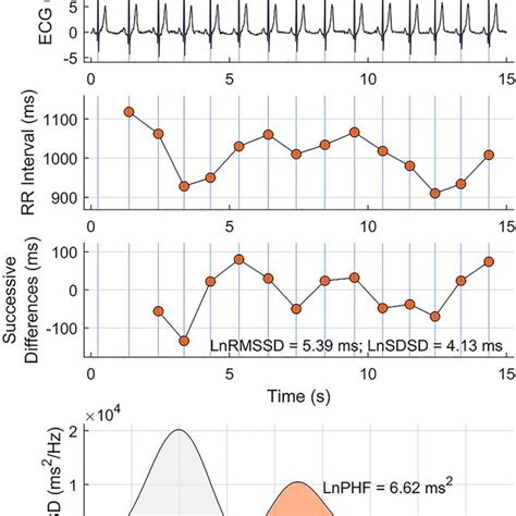 Image result for Heart Rate Variability Test