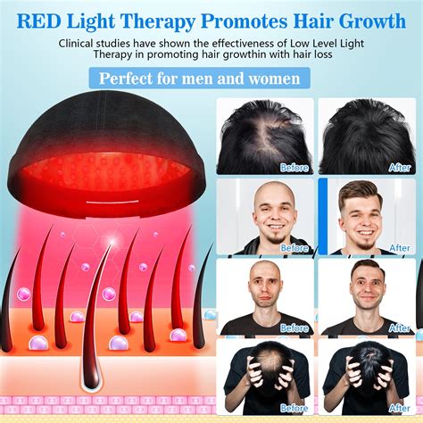 Best Red Light Therapy For Hair Growth At Home | Shelly Lighting