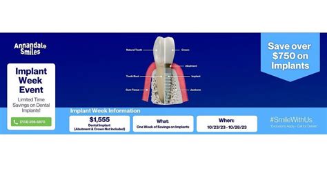 Implant Week - Savings on Dental Implants!, Annandale Smiles, 23 ...