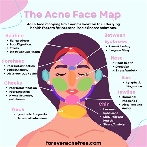 The acne face map acne face mapping what your breakouts mean acne solutions opens a new tab ...