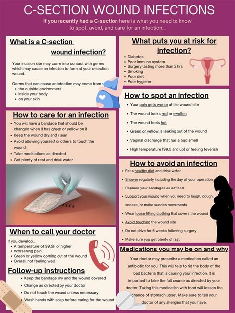 C-Section Wound 的图像结果
