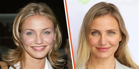 Cameron Diaz’s Plastic Surgery Changed Her Face ‘in a Weird Way’