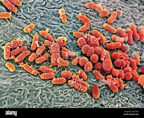 Bacteria in the nose. Coloured scanning electron micrograph (SEM) of ...